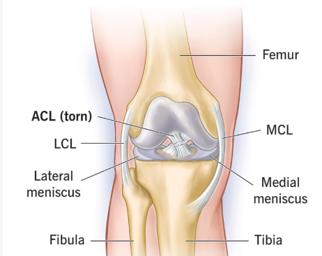 ACL/ MCL / PLC Repair / Reconstruction