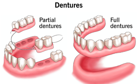 Dentures
